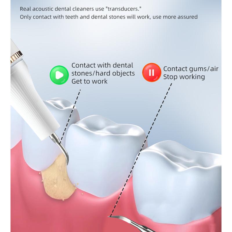 Electric Plaque Remover for Teeth, Tartar Remover for Teeth 3 Modes, 4 Heads, Teeth Cleaning Kit for Home