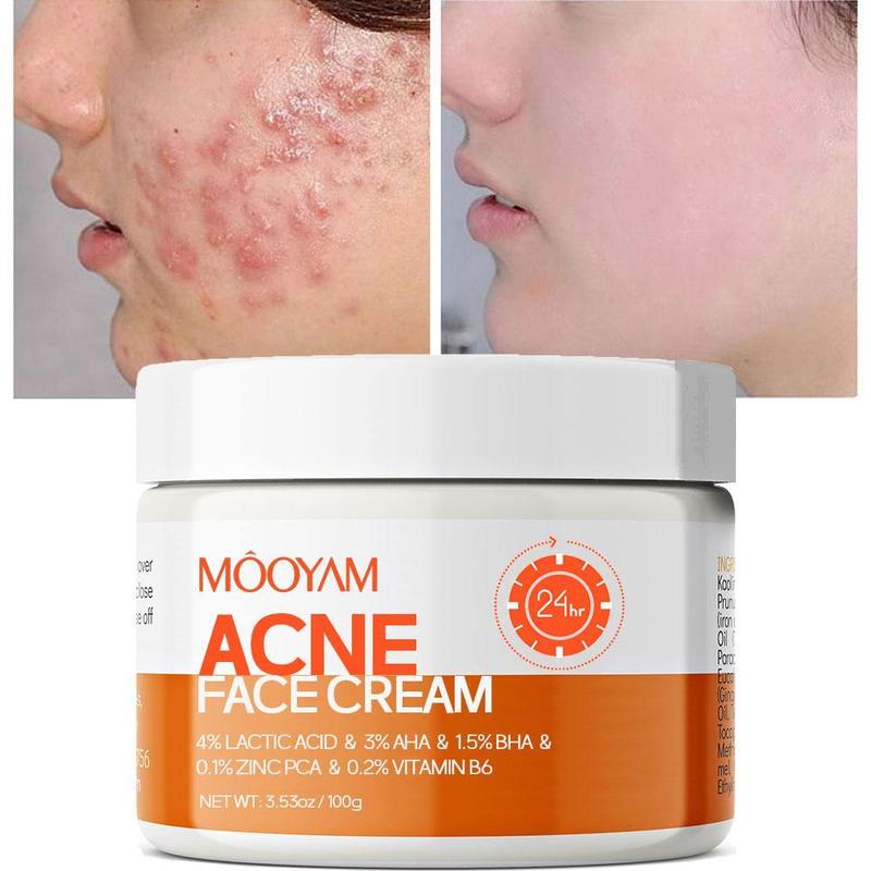 MOOYAM Acne Scar Treatment Cream 50ml Centella & Snail Repair Cream Post-Acne Marks Removal Acne&Pimple Treatment Fragrance Free Paraben Free Skincare Salicylic Skin Repair Sensitive Teens Scent Aroma