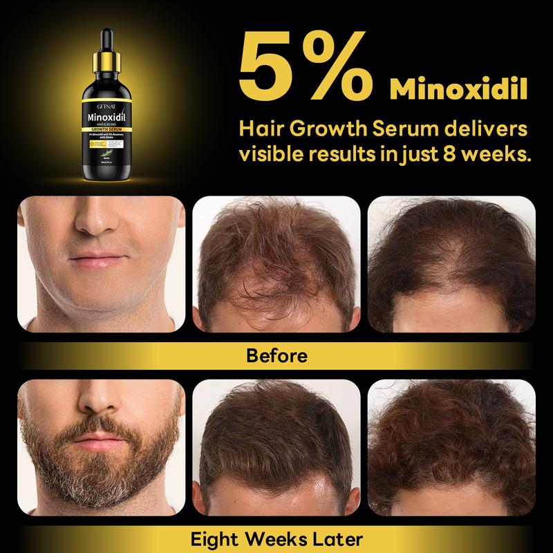 GFTNAT 5% Minoxidil Hair Serum for man and women,Hair Growth Serum with tool,Promotes Healthy Hair and Beard Growth and Thickness