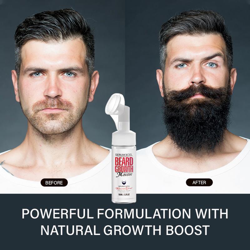 Serumxcel Beard Growth Mousse - For Men, Prevents Hair Loss, Nourishes Roots, Provides Nutrients, Promotes Beard Growth