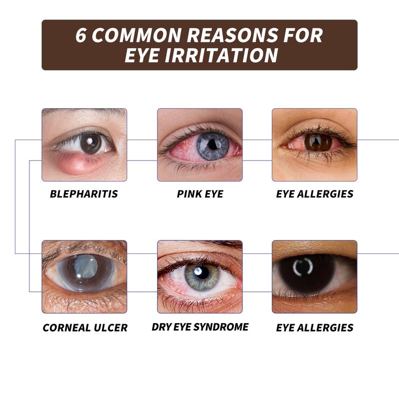 EELHOE Eye Care Lubricating Spray Relieves Eye Fatigue, Dry Eyes, Red Eyes, Blurred Vision, Eye Protection Spray