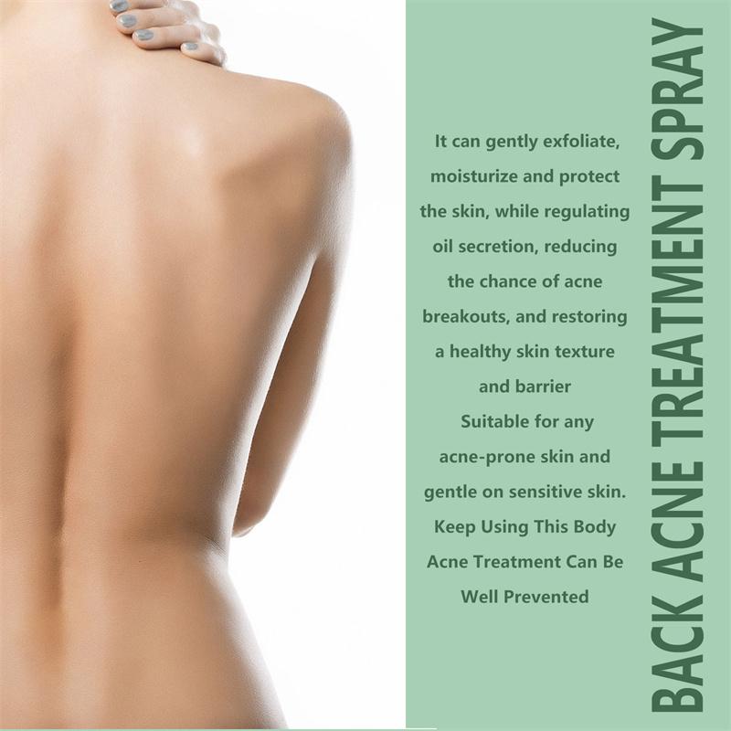 Back Acne Treatment Spray, Herbaluxy Back Acne spray, Anti Acne Marks Spot Removal Serum Moisturizing, Acne Treatment for Clear Back and Body Acne Moisture Skincare Gentle Sensitive Moisturizer Moisturize Hydrating Skin Repair acne treatment