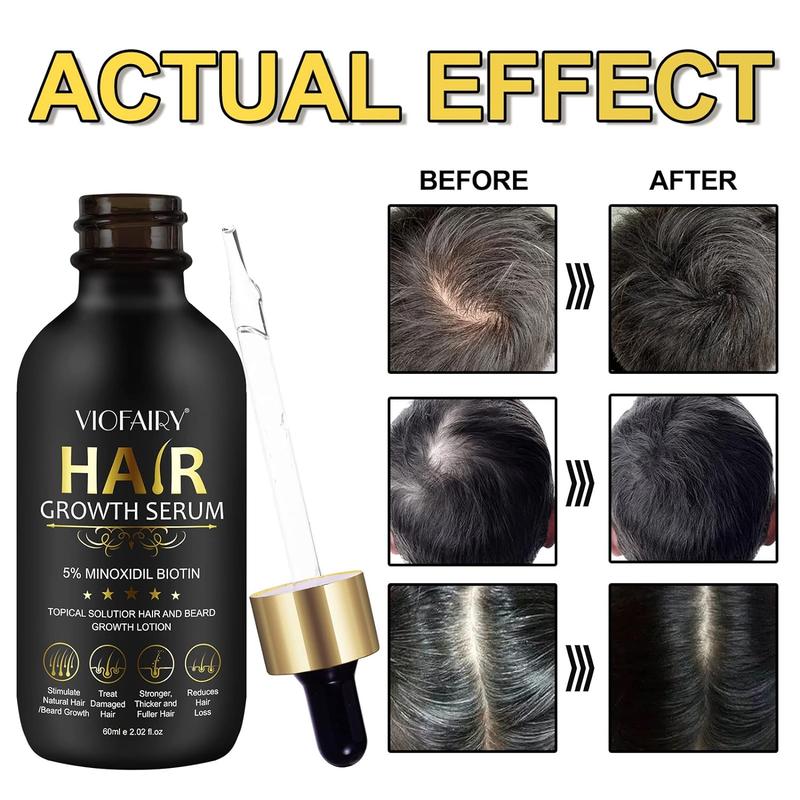 5% Minoxidil for ALL natural Hair Growth Oil, Biotin Serum Hair Regrowth Treatment for Scalp Hair Loss & Repairing-Restore Haircare