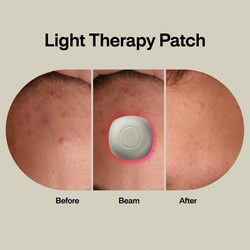 ACNE • LIGHT PIMPLE PATCH