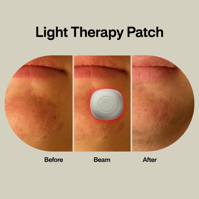 ACNE • LIGHT PIMPLE PATCH