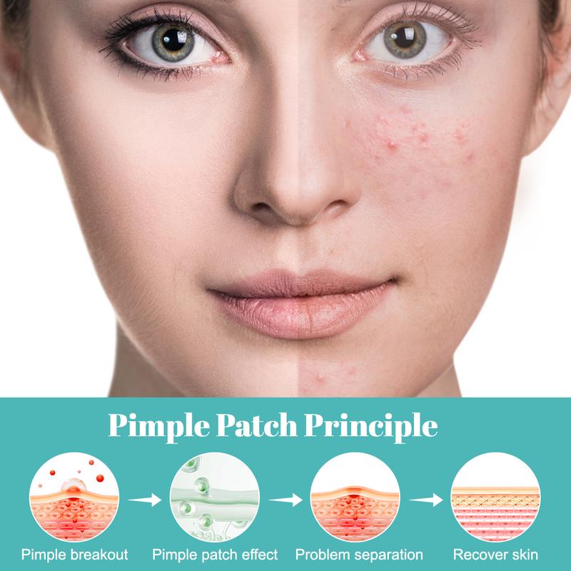 GHH Hydrocolloid Texture Acne Patches, Mint and Gentle For Skincare SkinRepair - 5 colors, 3 sizes(10mm,12mm,14mm) 200 PCS Star Pimple Patch