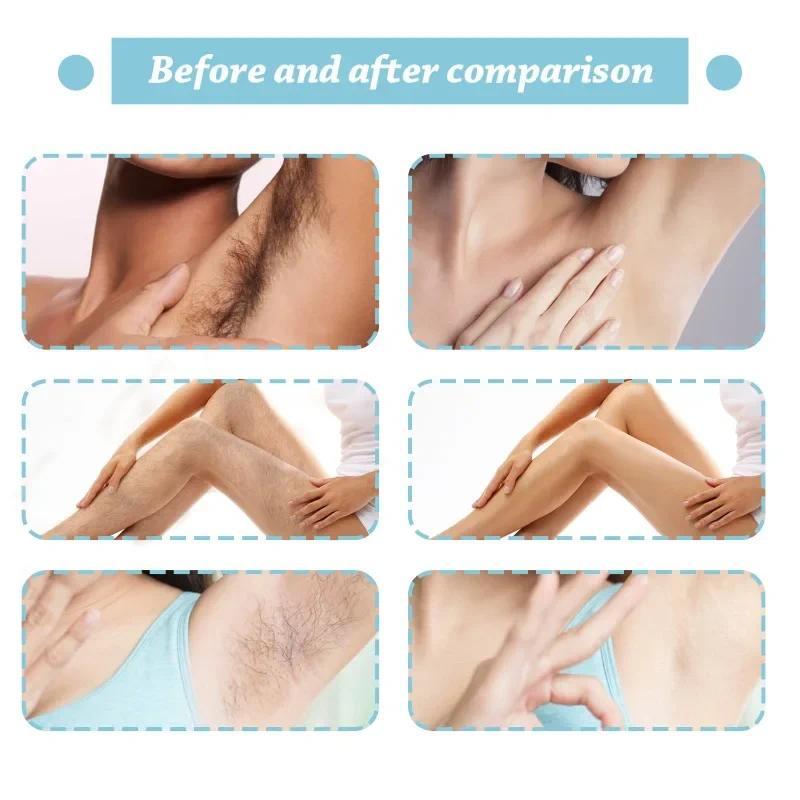 Women Painless Hair Remover for Armpit Men Permanent Hair Removal Spray Leg Arm Hair Growth Inhibitor Body Fast Depilatory Cream