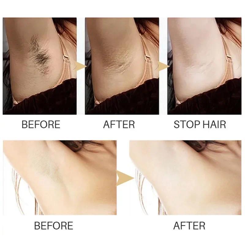 Women Painless Hair Remover for Armpit Men Permanent Hair Removal Spray Leg Arm Hair Growth Inhibitor Body Fast Depilatory Cream