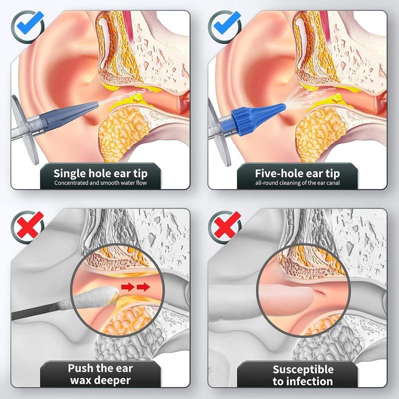 Manual Ear Wax Removal Kit, 1 Set Ear Cleaning Kit, Ear Wax Removal Tool, Safe and Effective Ear Cleaning Tool for Home & Travel