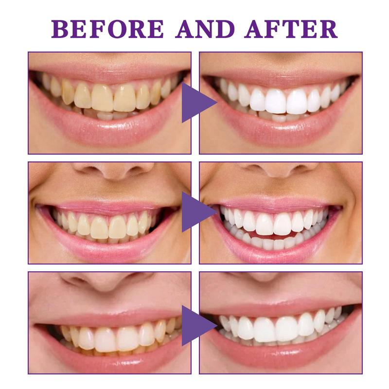 V34 Purple Toothpaste forTeeth Whitening ,Purple Toothpaste Whitening,smilekit V34 ColorCorrector Serum, Stain Removing smilekit 30-90ML Oral Restore