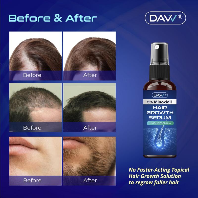 Davv 5% Minoxidil Hair Growth Serum For Men 60 ML