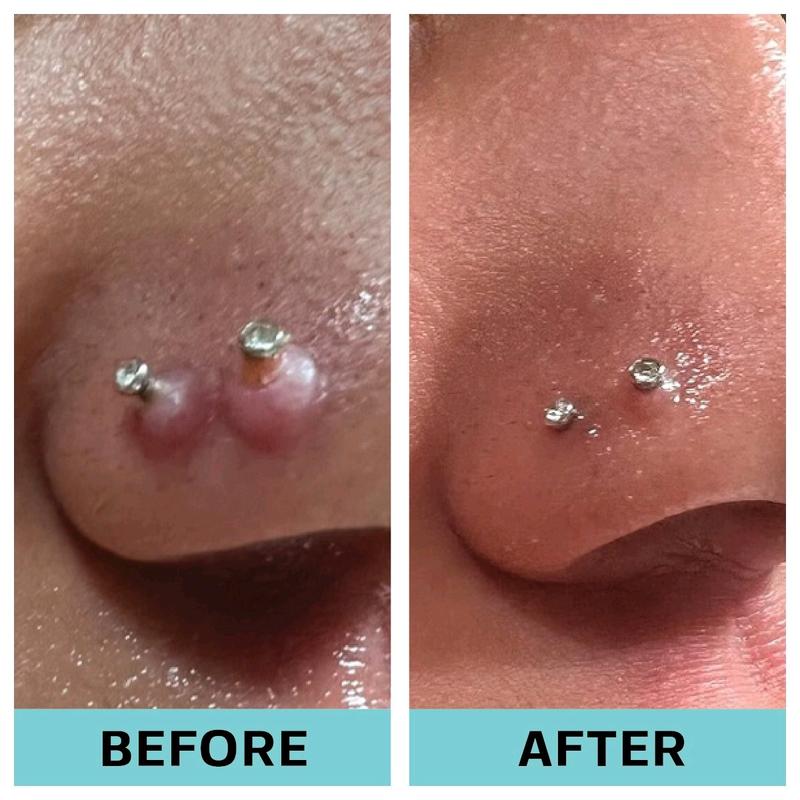 Base Labs Piercing Bump & Keloid Bump Removal Solution | Soothing Piercing Aftercare | Piercing Bump Keloid Scar Removal | Ear & Nose Piercing Cleaner for Keloid Bumps | Piercing Aftercare Oil | 15ml