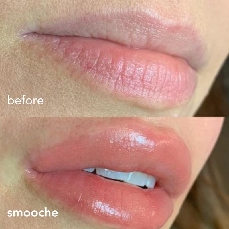 Smooche Cosmetics - Normal Lip Plumper