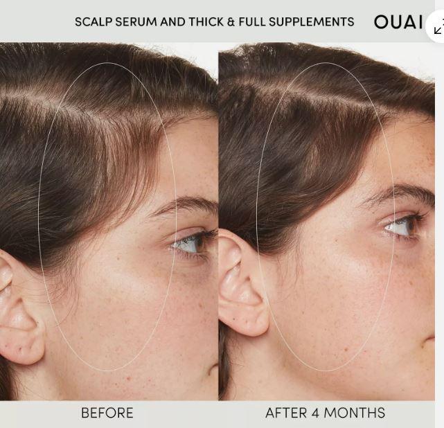 OUAI Scalp Serum - Supports Thicker Fuller Hair 2 oz